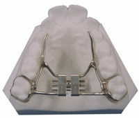 Palatal Expander - Pediatric Dentistry in Lakewood, WA